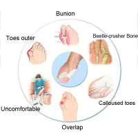 Silicone Bunion Relief Toe Sleeves