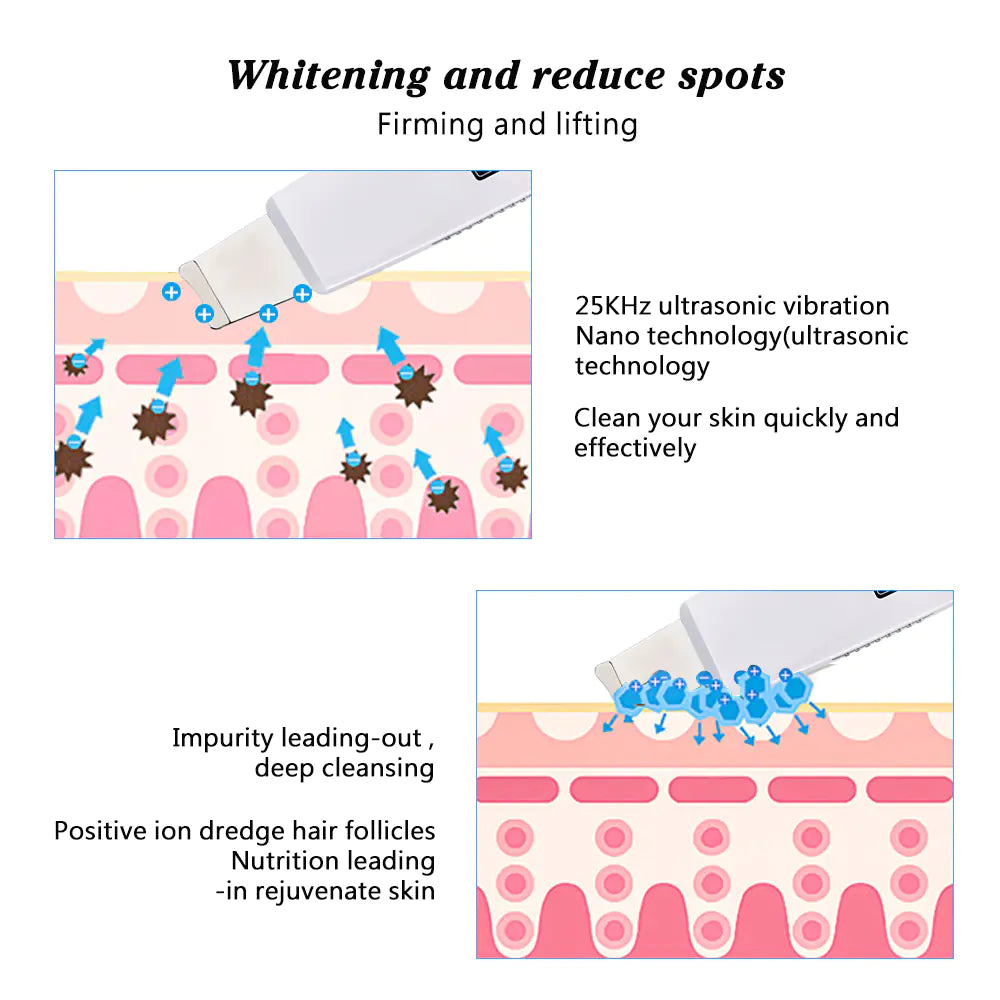 Ultrasonic Skin Refiner with Pore Vacuum