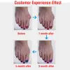 Silicone Bunion Relief Toe Sleeves