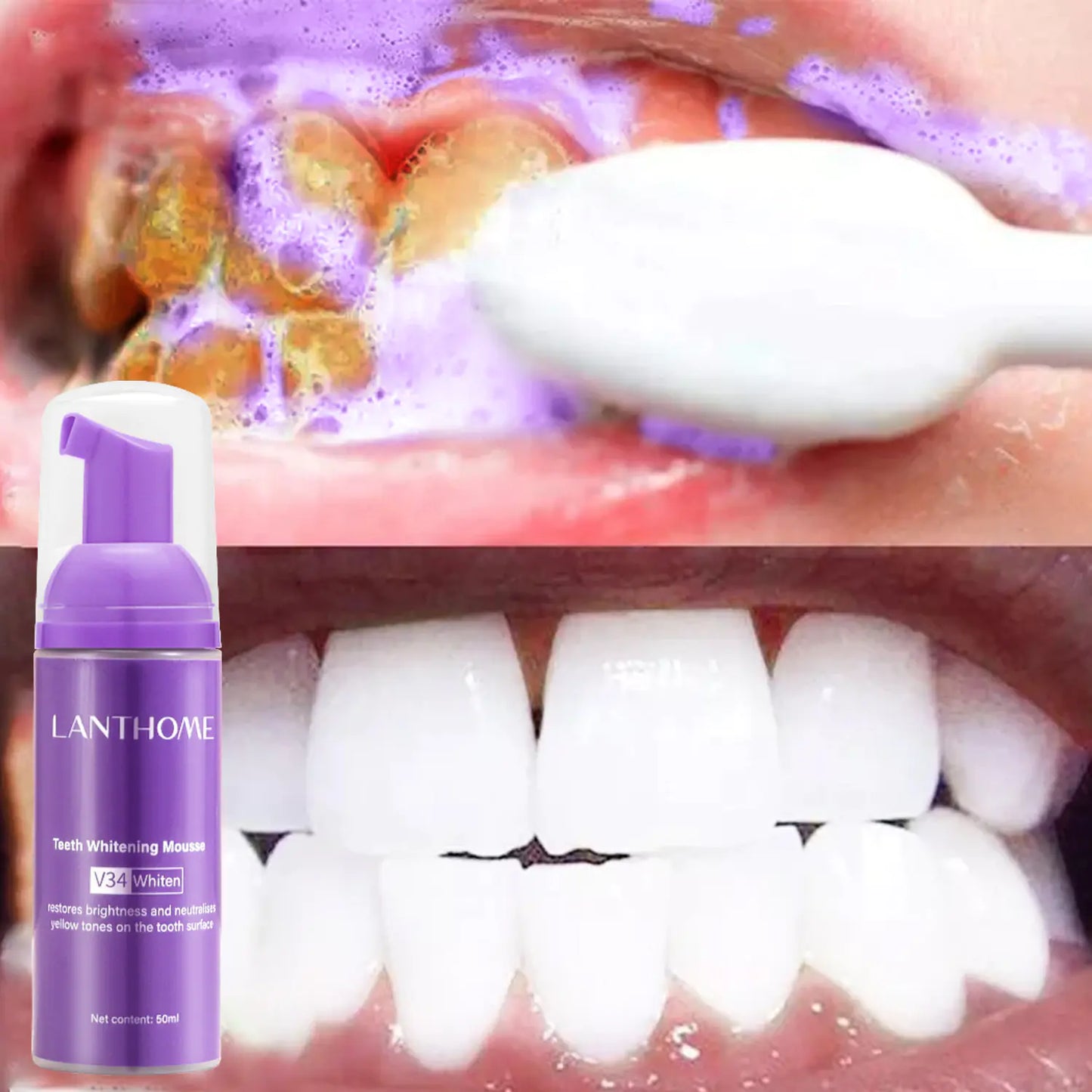 BrightSmile V34 Whitening Mousse