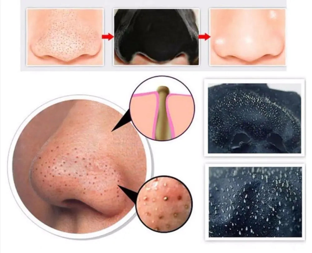 Charcoal Pore-Cleansing Mask Set