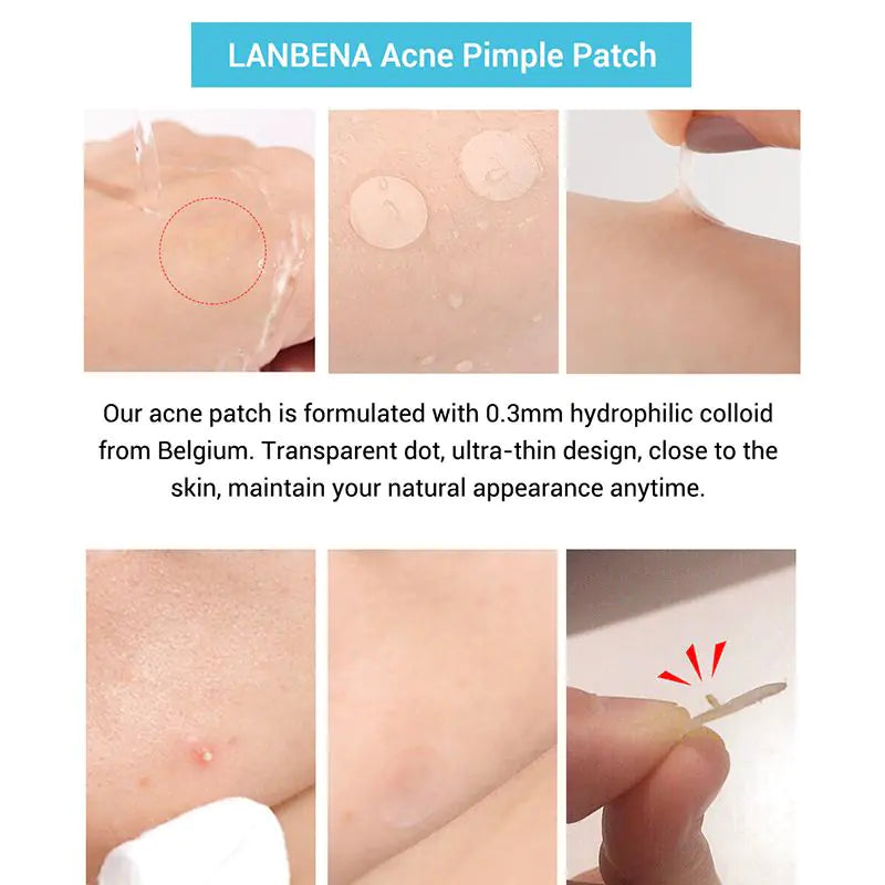 Tea Tree Acne Healing Patches 24/7