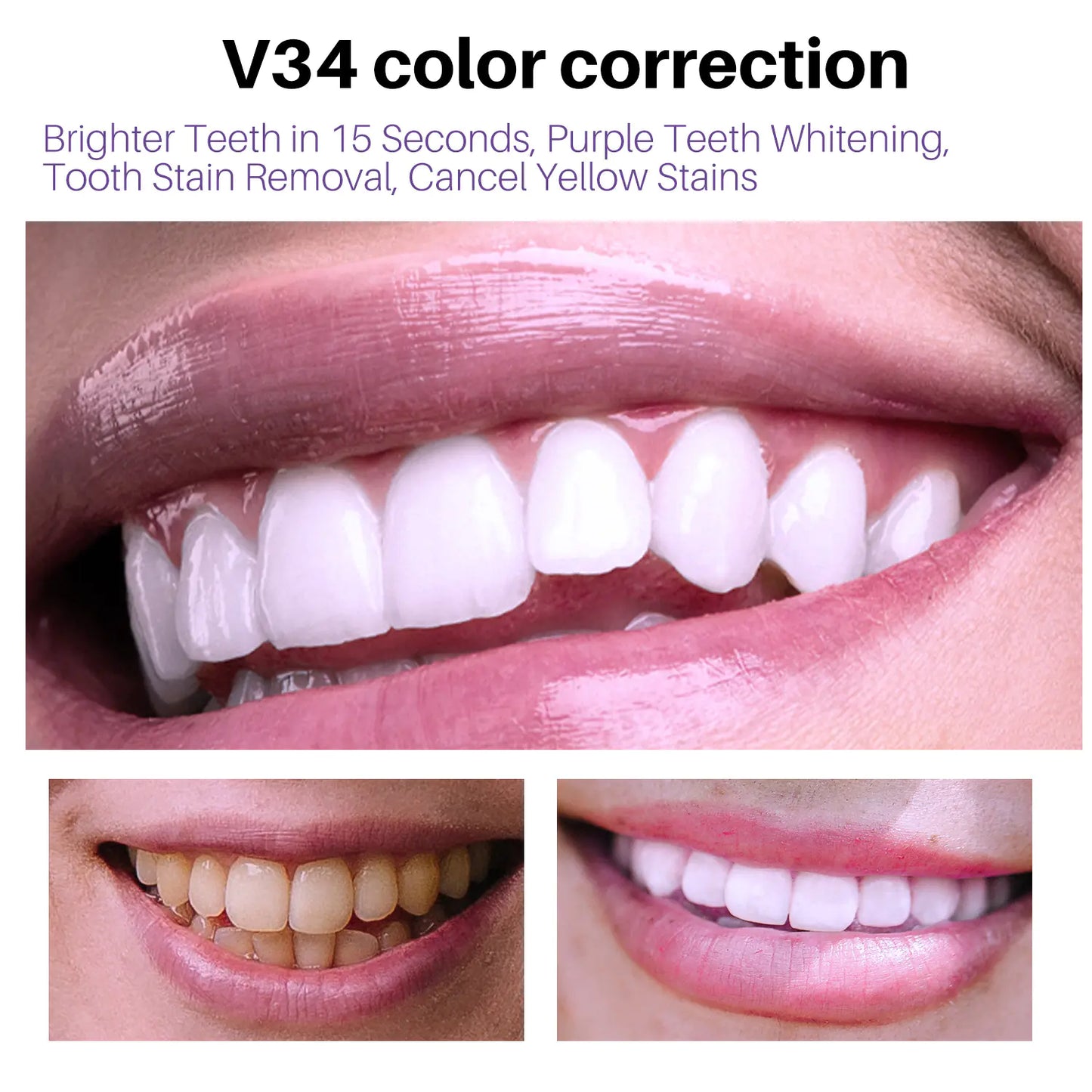 BrightSmile V34 Whitening Mousse