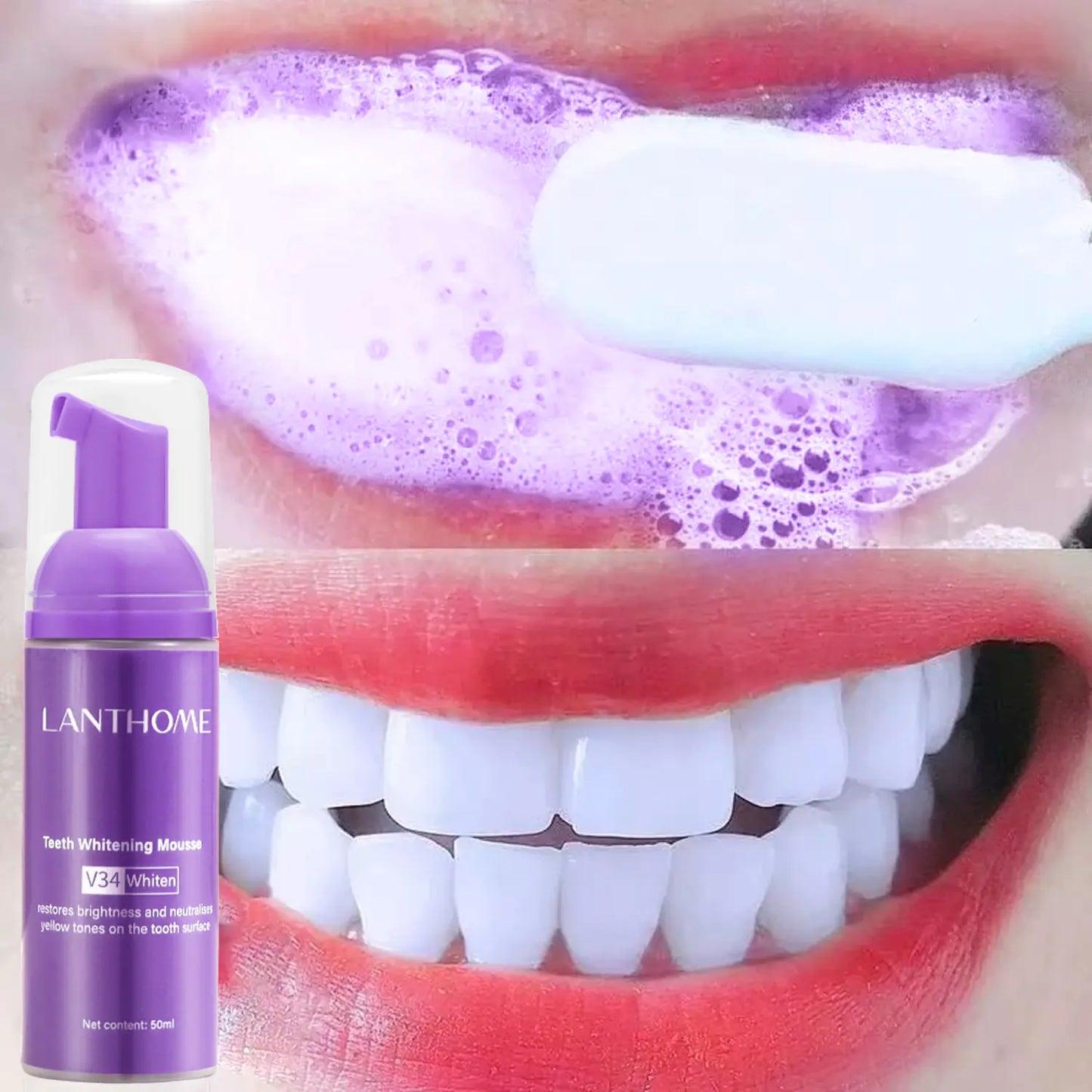 BrightSmile V34 Whitening Mousse